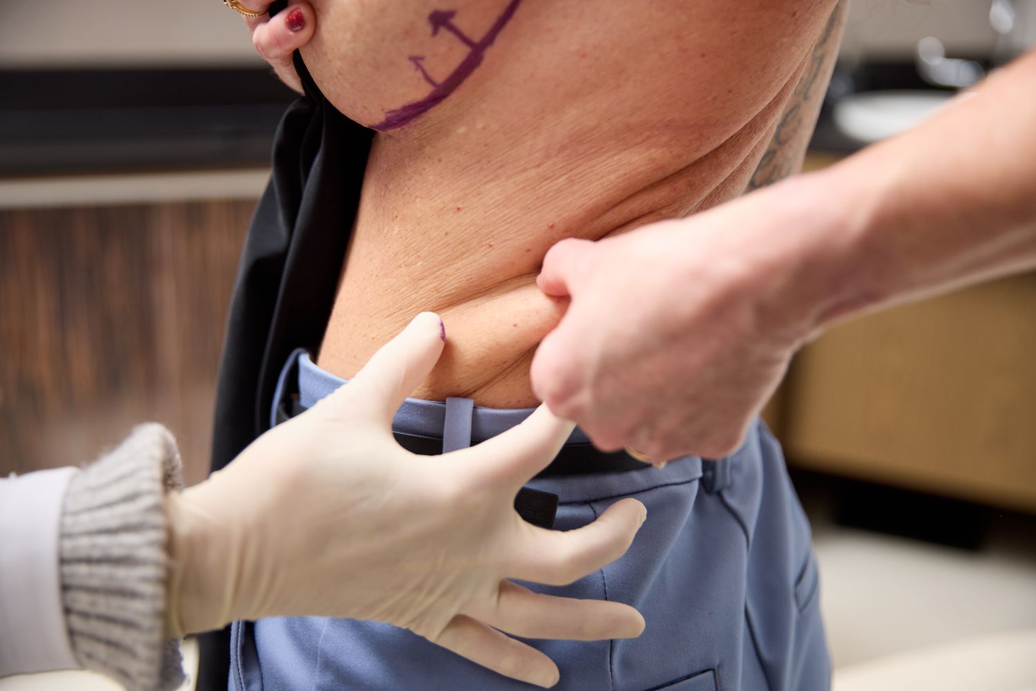 Patient preparation for a medical procedure.