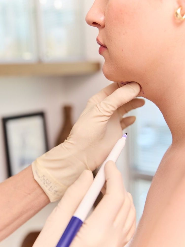 Dermatologist marking skin for a procedure.
