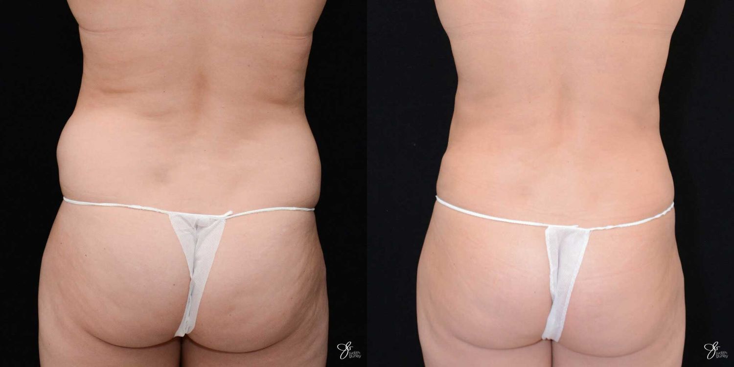 Before and after body image comparison.