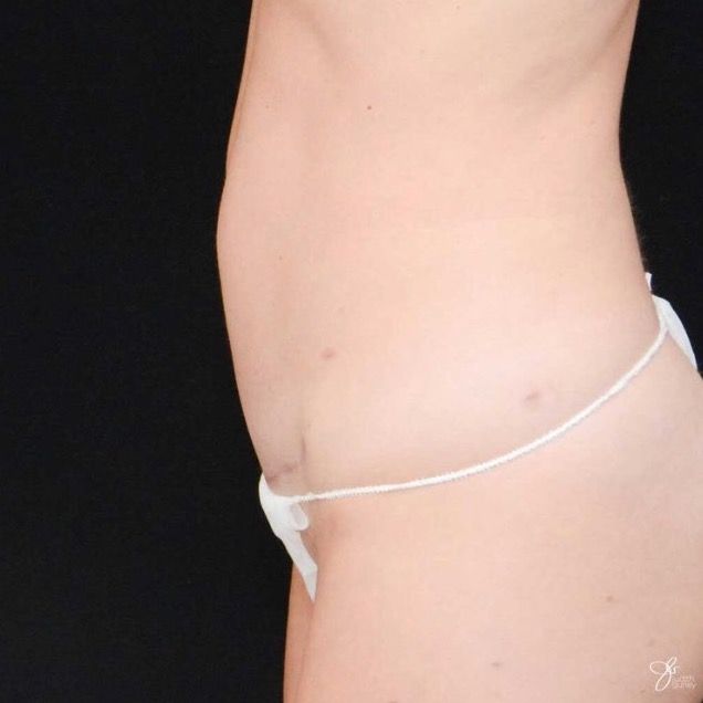 Side profile of person wearing minimal clothing.