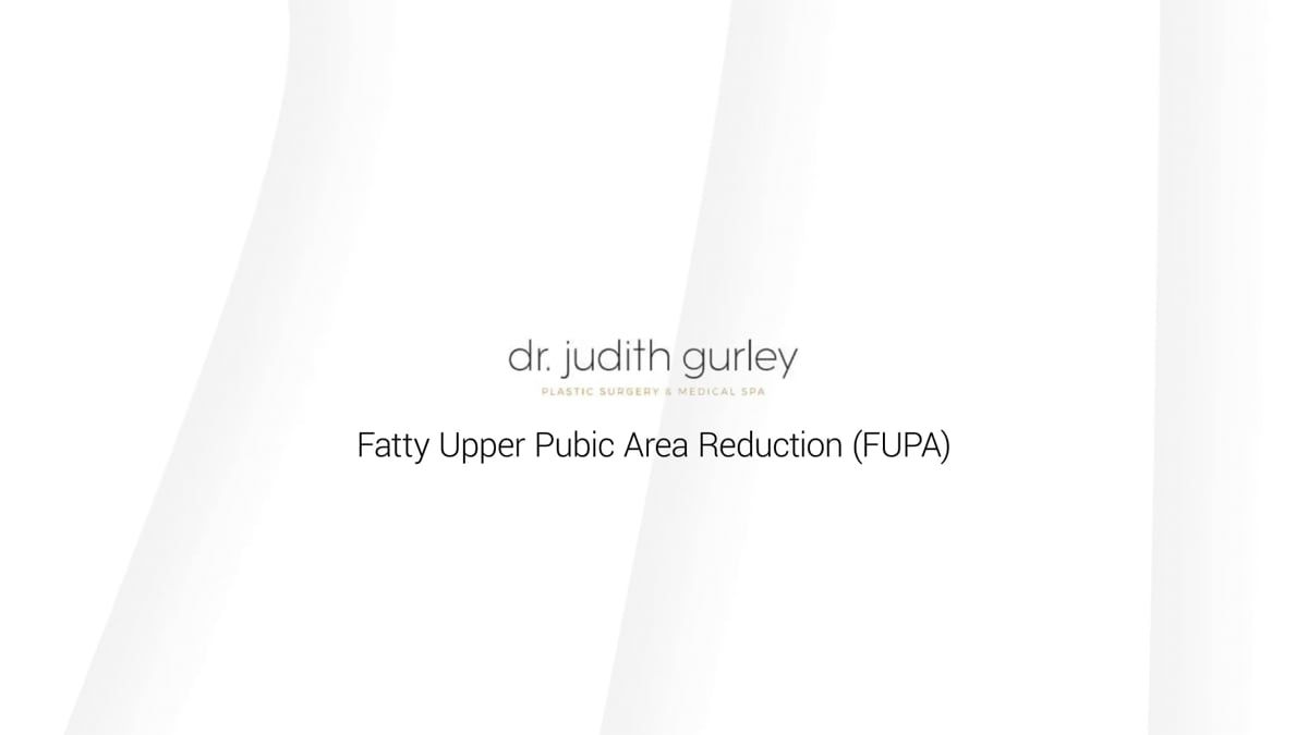 Fatty upper pubic area reduction information.
